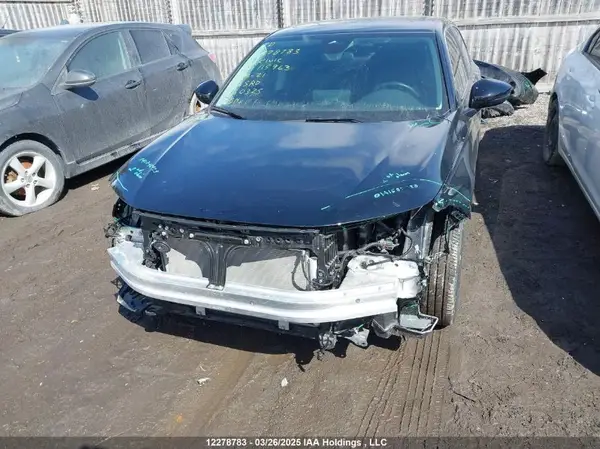 2HGFE2F34RH115963 2024 HONDA CIVIC - Image 2