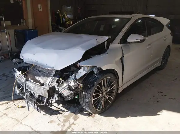 KMHD04LB9HU330709 2017 HYUNDAI ELANTRA - Image 2