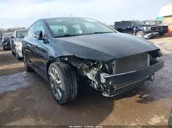 KMHD84LF9HU119666 2017 HYUNDAI ELANTRA