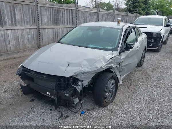 KMHLM4DG3RU648787 2024 HYUNDAI ELANTRA - Image 2